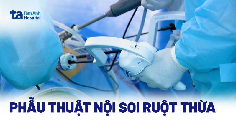 Ca Mổ Ruột Thừa Kéo Dài Bao Lâu? Thông Tin Bạn Cần Biết Từ Chuyên Gia